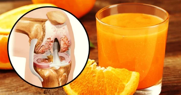 قویترین غضروفسازهای طبیعی و خانگی برای سلامت مفاصل