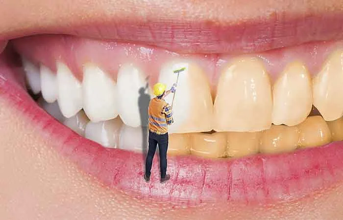 متن برای تبلیغ دندانپزشکی